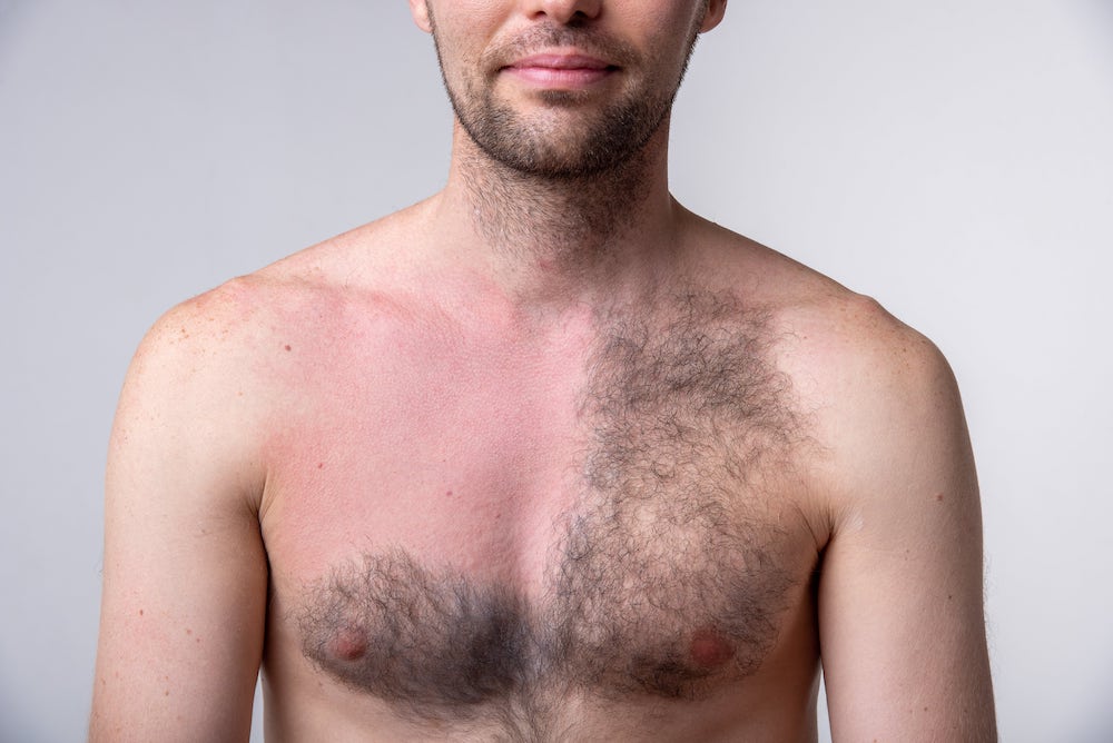Guide: Voksning af bryst og ryg til mænd